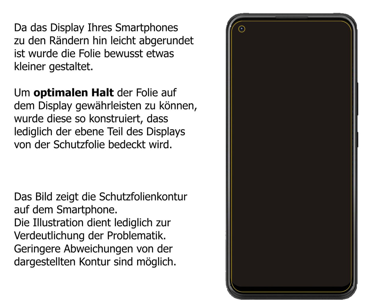 Screen Protector for ZTE Blade X1 5G Privacy Filter 4-Way Protection dipos