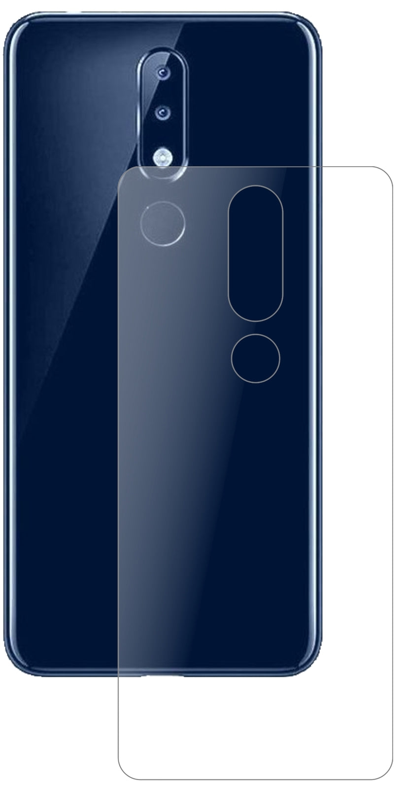 Nokia5.1 Plus Rückseite mit aufgebrachter dipos Panzerfolie, die lästige Fingerabdrücke minimiert