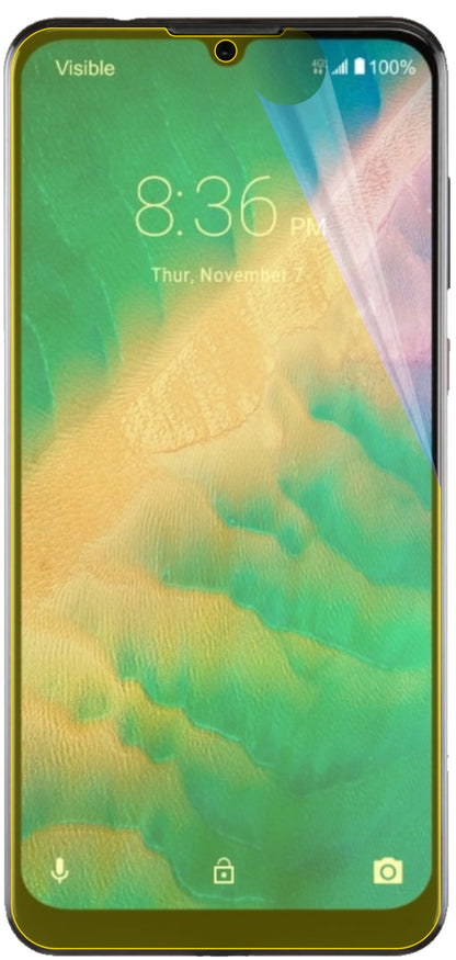 dipos Displayschutz für ZTE Blade 10 Prime, transparente Oberfläche, geringe Dicke und perfekte Passform
